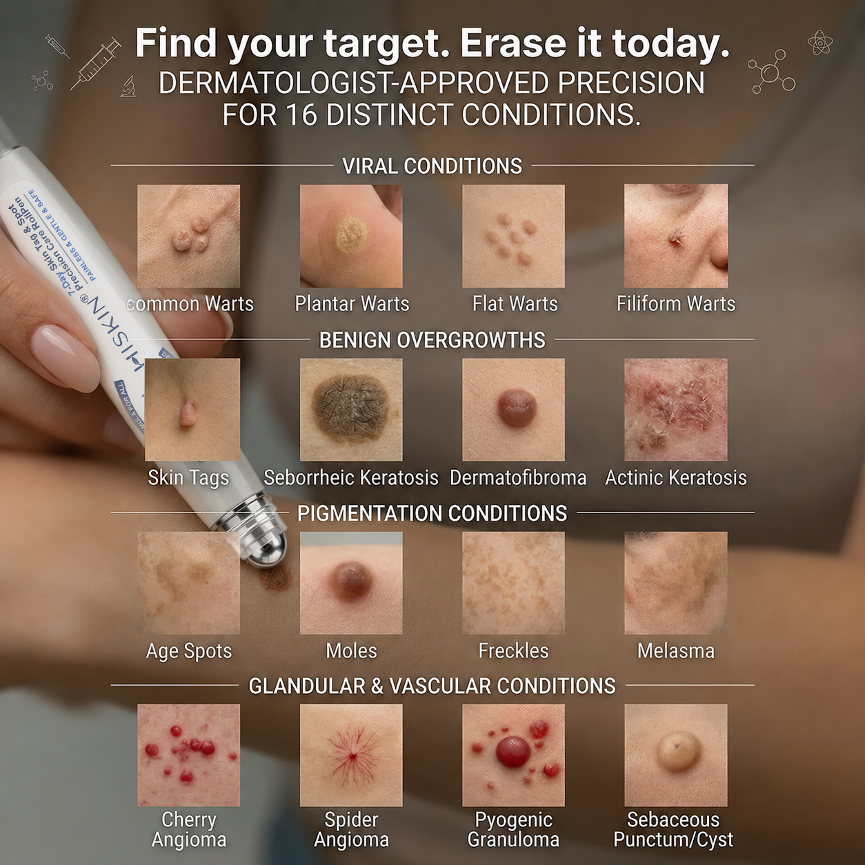 🎁 Only a few 𝐇𝐈𝐒𝐊𝐈𝐍® Wart Removal Pens left — enjoy an extra 30% OFF today! ✨ Easily target unwanted warts from the comfort of your home and support smoother, clearer-looking skin. Don't miss out—this limited-time offer won't be back anytime soon!